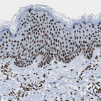 Immunohistochemical staining of human skin shows strong nuclear positivity in squamous epithelial cells.