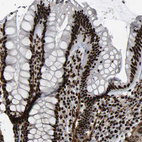 Immunohistochemical staining of human colon shows strong nuclear positivity in glandular cells.