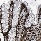 Immunohistochemical staining of human colon shows strong nuclear positivity in glandular cells.