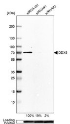 Anti-DDX5 Antibody