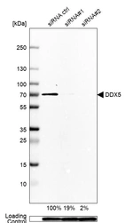 Western blot analysis in Rh30 cells transfected with control siRNA, target specific siRNA probe #1 and #2, using Anti-DDX5 antibody. Remaining relative intensity is presented. Loading control: Anti-GAPDH.