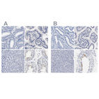 Immunohistochemical staining of human endometrium, gastrointestinal, liver and testis using Anti-AKAP4 antibody HPA020046 (A) shows similar protein distribution across tissues to independent antibody HPA005949 (B).
