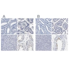 Immunohistochemical staining of human endometrium, gastrointestinal, liver and testis using Anti-AKAP4 antibody HPA020046 (A) shows similar protein distribution across tissues to independent antibody HPA005949 (B).