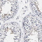 Immunohistochemical staining of human testis shows strong cytoplasmic positivity in spermatids.