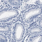 Immunohistochemical staining of human endometrium shows no cytoplasmic positivity in glandular cells as expected.