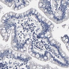 Immunohistochemical staining of human small intestine shows no cytoplasmic positivity in glandular cells as expected.