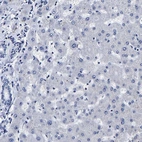 Immunohistochemical staining of human liver shows no cytoplasmic positivity in hepatocytes as expected.