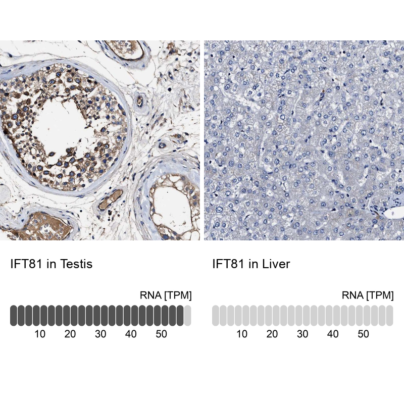 Anti-IFT81 Antibody