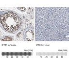 Anti-IFT81 Antibody