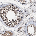 Immunohistochemical staining of human testis shows high expression.