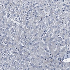 Immunohistochemical staining of human liver shows low expression as expected.