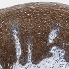 Immunohistochemical staining of human esophagus shows cytoplasmic positivity in squamous epithelial cells.
