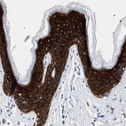 Immunohistochemical staining of human skin shows cytoplasmic positivity in epidermal cells.