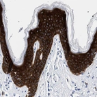 Immunohistochemical staining of human skin shows cytoplasmic positivity in epidermal cells.