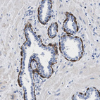 Anti-TRIM29 Antibody