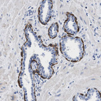 Immunohistochemical staining of human prostate shows cytoplasmic positivity in basal layer of glandular cells.