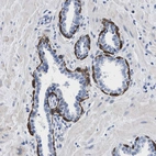 Immunohistochemical staining of human prostate shows cytoplasmic positivity in basal layer of glandular cells.