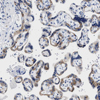Immunohistochemical staining of human placenta shows cytoplasmic positivity in trophoblastic cells.