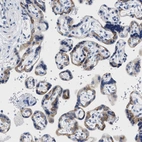 Immunohistochemical staining of human placenta shows cytoplasmic positivity in trophoblastic cells.