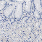 Anti-TRIM29 Antibody