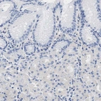 Immunohistochemical staining of human stomach shows no positivity in glandular cells as expected.