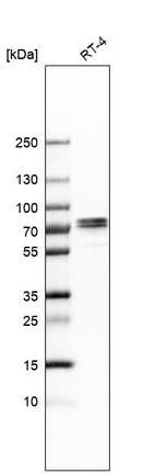 Western blot analysis in human cell line RT-4.