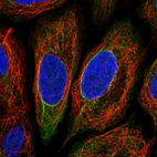 Immunofluorescent staining of human cell line SiHa shows localization to intermediate filaments.