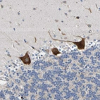Anti-AIMP2 Antibody