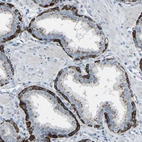 Immunohistochemical staining of human prostate shows moderate to strong cytoplasmic positivity in glandular cells.