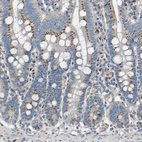 Immunohistochemical staining of human duodenum shows strong granular cytoplasmic positivity in glandular cells.