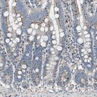 Immunohistochemical staining of human duodenum shows strong granular cytoplasmic positivity in glandular cells.