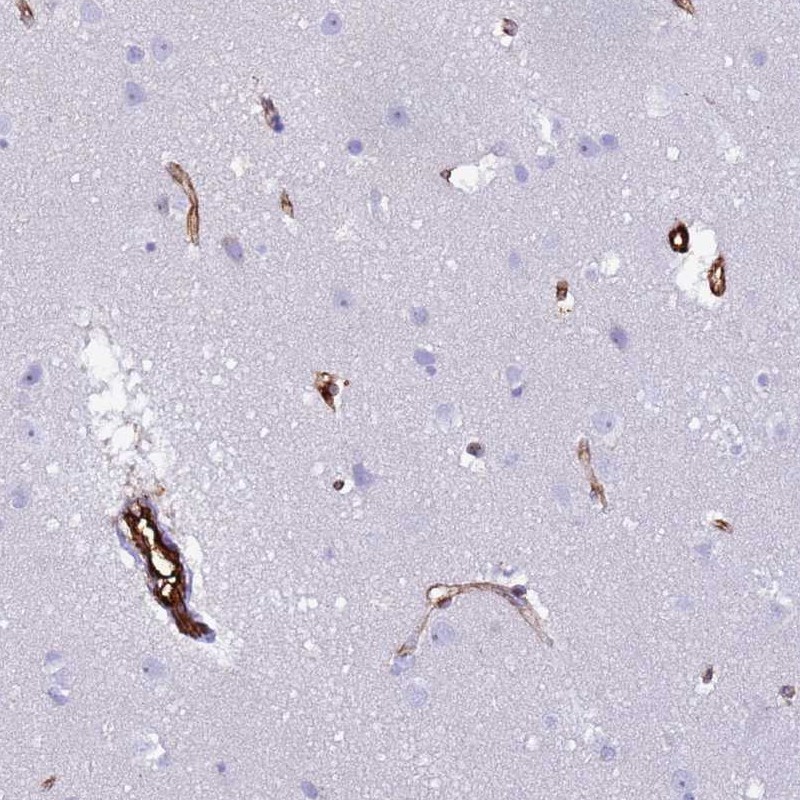 Anti-NXPH1 Antibody
