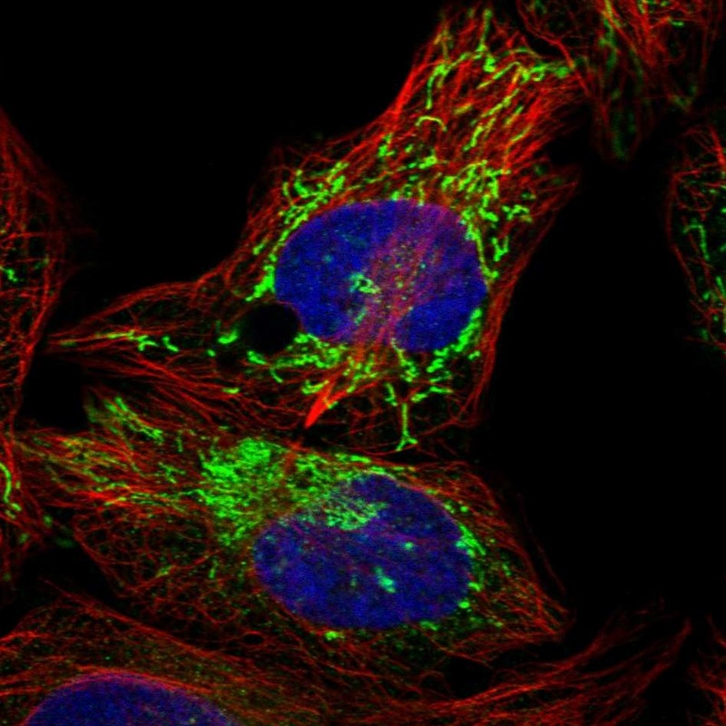 Anti-PPM1K Antibody