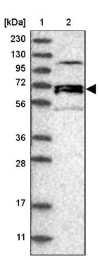 Lane 1: Marker [kDa] 230, 130, 95, 72, 56, 36, 28, 17, 11_br/_Lane 2: Human cell line RT-4