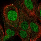 Immunofluorescent staining of human cell line HaCaT shows localization to nucleus & vesicles.