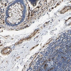 Immunohistochemical staining of human colon shows strong cytoplasmic positivity in endothelial cells.