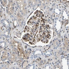 Immunohistochemical staining of human kidney shows strong cytoplasmic positivity in cells in glomeruli.