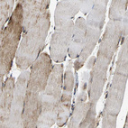 Immunohistochemical staining of human skeletal muscle shows moderate cytoplasmic positivity in myocytes.