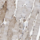 Immunohistochemical staining of human skeletal muscle shows moderate cytoplasmic positivity in myocytes.