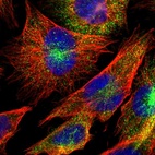 Immunofluorescent staining of human cell line U-251 MG shows localization to cytosol.