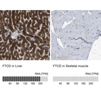 Anti-FTCD Antibody