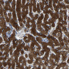 Immunohistochemical staining of human liver shows strong cytoplasmic positivity in hepatocytes.