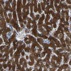 Immunohistochemical staining of human liver shows strong cytoplasmic positivity in hepatocytes.