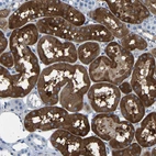 Immunohistochemical staining of human kidney shows strong cytoplasmic positivity in cells in tubules.