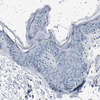 Anti-FTCD Antibody