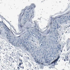 Immunohistochemical staining of human skin shows no positivity in squamous epithelial cells as expected.