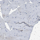 Immunohistochemical staining of human skeletal muscle shows no positivity in myocytes as expected.