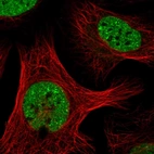 Immunofluorescent staining of human cell line U-2 OS shows localization to nucleoplasm.