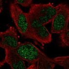 Immunofluorescent staining of human cell line RH-30 shows localization to nucleoplasm.