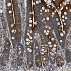Anti-VPS41 Antibody